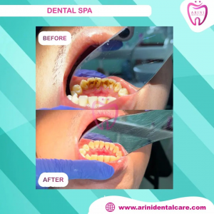 Dental Spa Klinik Gigi Arini Dental Care