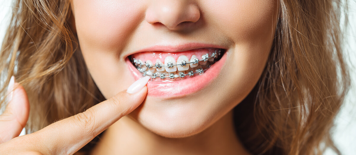 ortho atau behel Arini dental Care