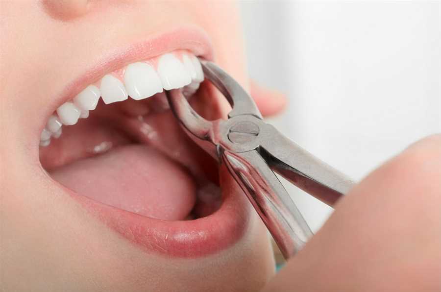 pencabutan gigi di Arini Dental Care