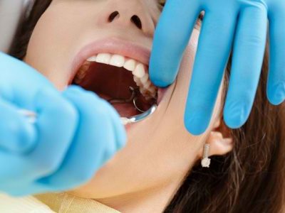Mengapa Penderita Hipertensi Tidak Boleh Melakukan Pencabutan Gigi?