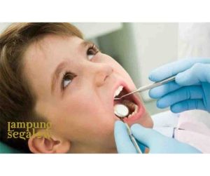 Faktor risiko gigi berlubang pada anak-anak