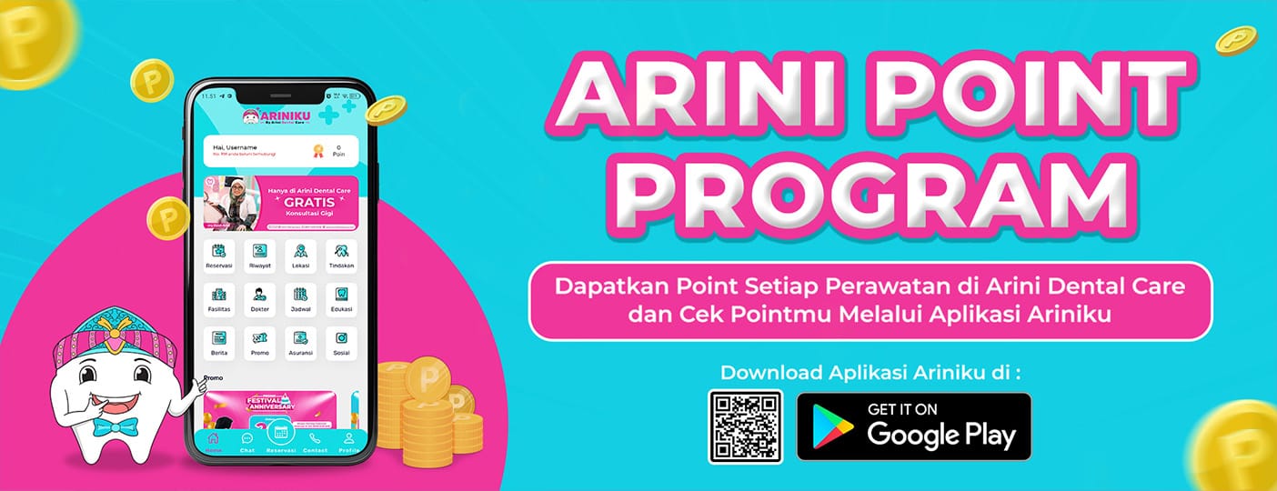 Point Program