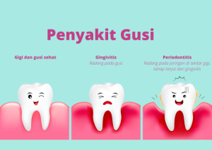 Apa saja Faktor Risiko Masalah Mulut dan Gigi?