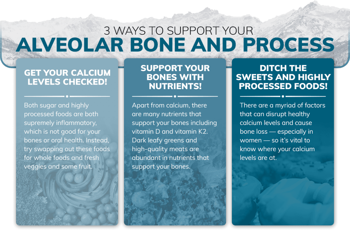 Apa itu Alveolektomi ?