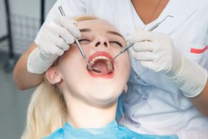 Hal-hal yang dapat menyebabkan terkikisnya enamel gigi