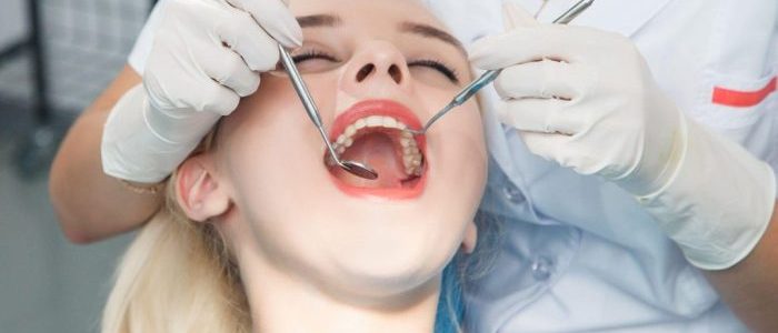 Hal-Hal Yang Dapat Menyebabkan Terkikisnya Enamel Gigi